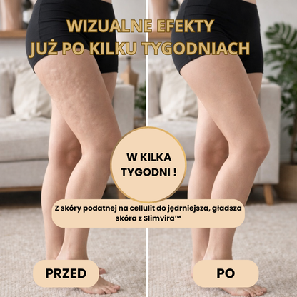 Slimvira™ – 4w1 domowy masażer dla jędrniejszej skóry